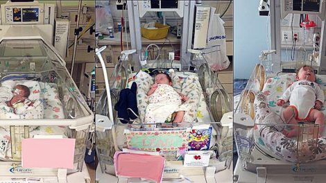 На III Евро–Азиатском неонатальном форуме обсудили проблемы нейроразвивающего ухода