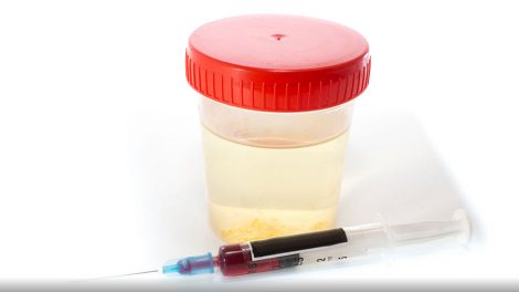 В Свердловской области открываются пункты быстрого тестирования на ВИЧ