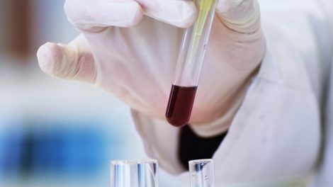 “Яндекс” назвал города, быстрее других восстанавливающиеся после пандемии