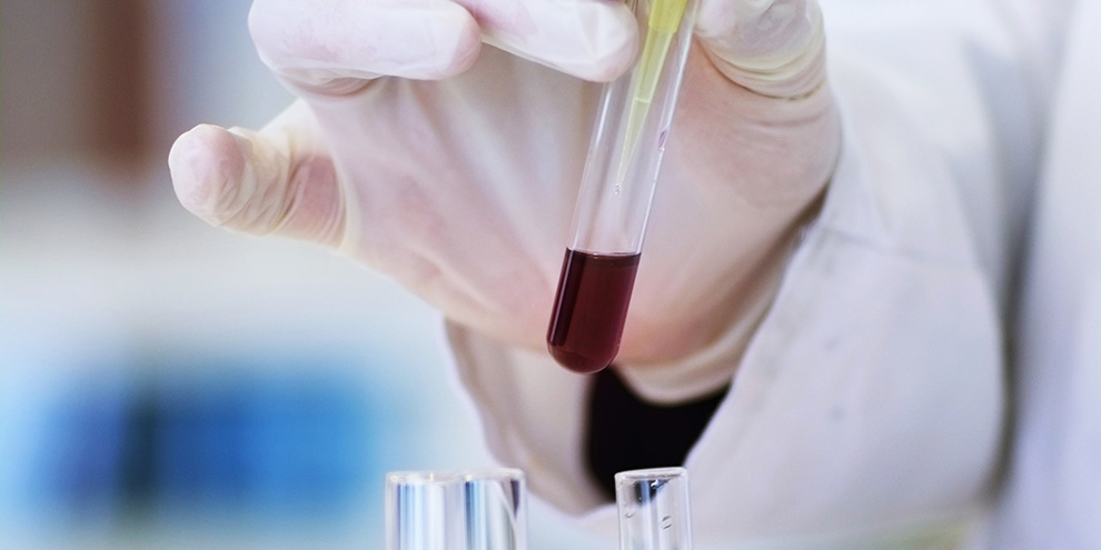 “Яндекс” назвал города, быстрее других восстанавливающиеся после пандемии