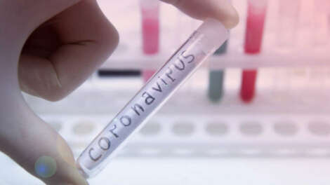 В Турции обязали прибывающих в страну предоставлять отрицательный тест на COVID-19