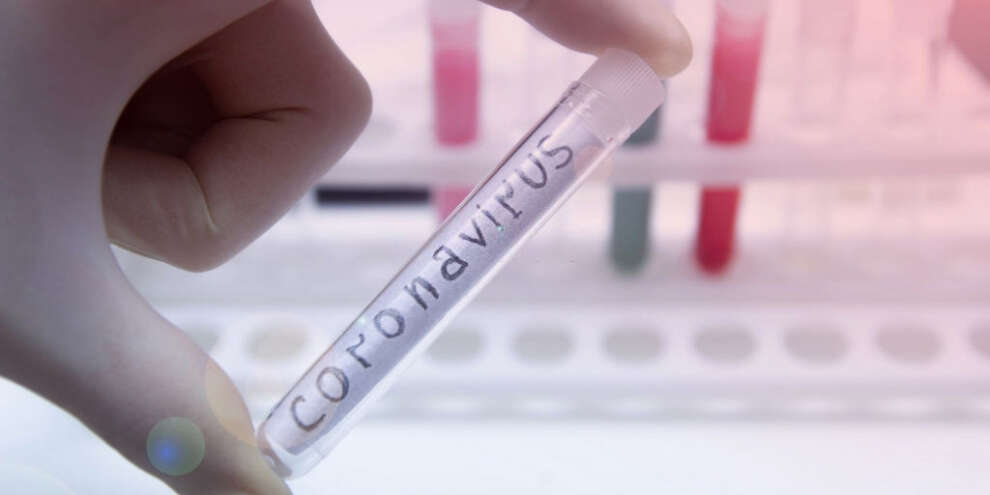 В Турции обязали прибывающих в страну предоставлять отрицательный тест на COVID-19